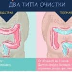 анальному