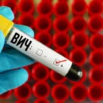Почему в России не эффективна профилактика ВИЧ?