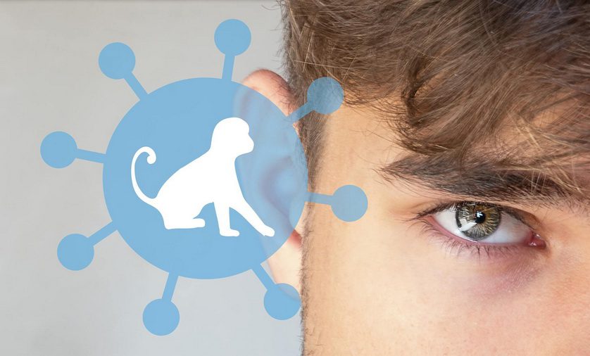 оспой обезьян