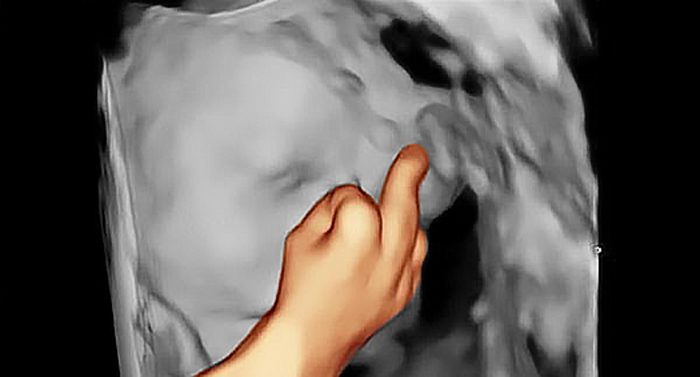 Гомофобия и рождаемость