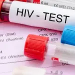 На изображении склянка с кровью и подпись ВИЧ тест (HIV test)