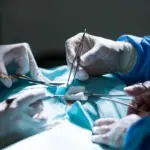 операционный стол, хирурги в медицинских перчатках и с инструментами проводят операцию