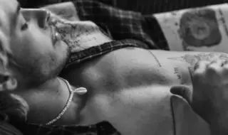 чёрно-белое фото трансгендерного мужчины с заметными шрамами от верхней операции