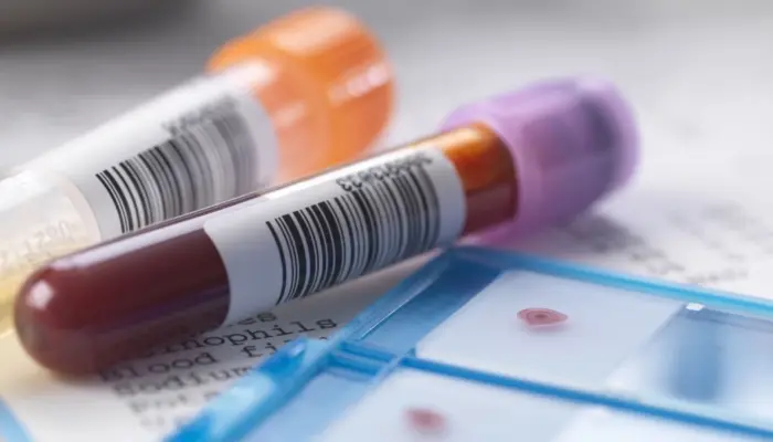 фотография двух пробирок с кровью для теста