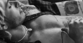 чёрно-белое фото трансгендерного мужчины с заметными шрамами от верхней операции